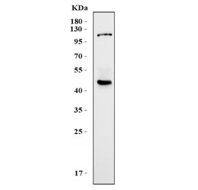 KCNN4 Antibody / KCa3.1 / SKCa4