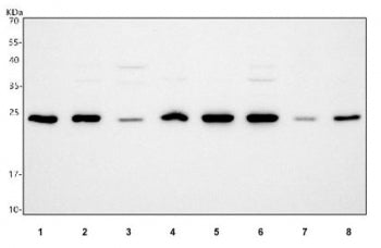 Western blot testing of 1) rat testis, 2) rat brain, 3) rat liver, 4) rat PC-12, 5) mouse testis, 6)