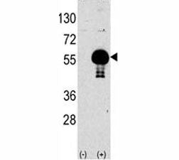 Western blot analysis of AKT2 antibody and 293 lysate transiently transfected with the human gene (2