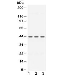 DHODH Antibody