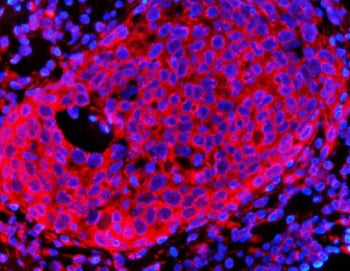 HMG CoA Reductase Antibody / HMGCR