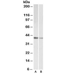 Western blot testing of human [A] and mouse [B] heart lysate with TNNT2 antibody at 0.1ug/ml