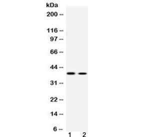 ATF4 Antibody