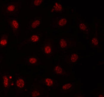 Immunofluorescent staining of FFPE human A549 cells with PRP31 antibody (red). HIER: steam section i