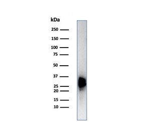 Western blot testing of human testis tissue lysate using Calbindin 2 antibody (clone CALB2/7029R). Predicted molecular weight ~29 kDa.