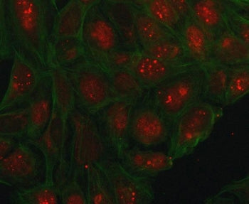 Immunofluorescent staining of FFPE human U-2 OS cells with PHC1 antibody (red) and DAPI nuclear stai