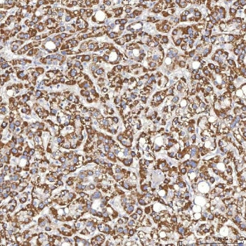 Thyroxine Binding Globulin Antibody / TBG / SERPINA7