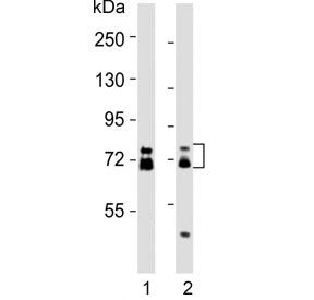 Western blot testing of human 1) HCT-116 and 2) MCF7 cell lysates with ESRP1 antibody. Predicted mol