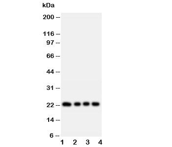 Western blot testing of FGF22 antibody and rat samples: 1. ovary; 2. ovary; 3. testis; 4. testis tis