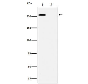 ACACA Antibody (pS79) / Acetyl CoA Carboxylase 1