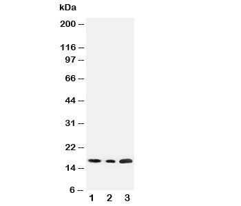 Western blot testing of SDHC antibody and Lane 1: rat liver; 2: HeLa; 3: Jurkat cell lysate