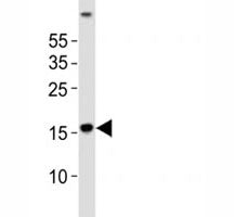 Zebrafish LC3A Antibody