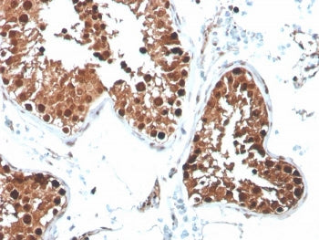 INHA Antibody / Inhibin alpha