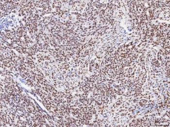 Fox2 Antibody / RBM9 / RBFOX2