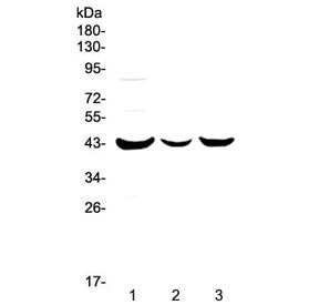 Western blot testing of human 1) MCF7, 2) HepG2 and 3) SK-OV-3 cell lysate with P2RY5 antibody at 0.