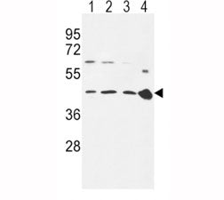CCR7 antibody western blot analysis in 293 (lane 1), Ramos (2), MDA-MB231 (3) cell line and mouse sp