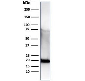 His Tag Antibody / Histidine