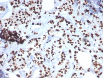 HSP70 Antibody / HSPA1B