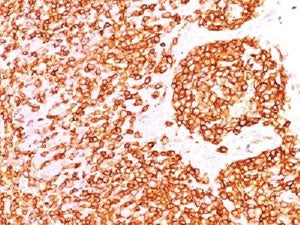 CD45RB Antibody (B-cell marker)