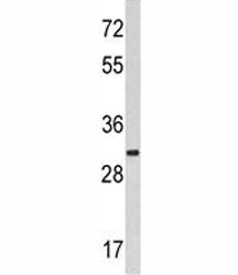 Western blot analysis of MARCKS antibody and HeLa lysate. Predicted molecular weight ~32 kDa.