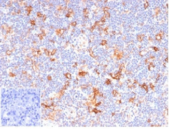 IHC staining of FFPE human lymph node tissue with recombinant CD86 antibody (clone C86/6500R). Negative control inset: PBS used instead of primary antibody to control for secondary Ab binding. HIER: boil tissue sections in pH 9 10mM Tris with 1mM EDTA for 20 min and allow to cool before testing.