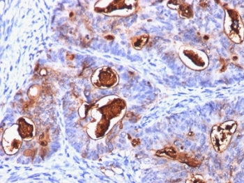 CEA Antibody / Carcinoembryonic Antigen