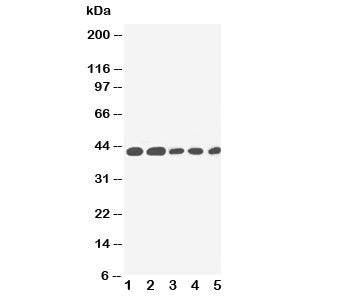 Western blot testing of IL-2 Receptor antibody and Lane 1: PANC; 2: HeLa; 3: Jurkat; 4: Raji; 5: CEM