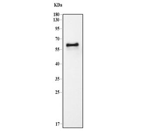 Western blot testing of mouse plasma lysate with Fetuin A antibody. Predicted molecular weight: 39-5
