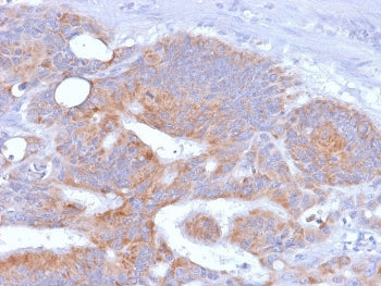 IHC testing of FFPE human colon with recombinant CD86 antibody (rC86/1146). Required HIER: boil tiss