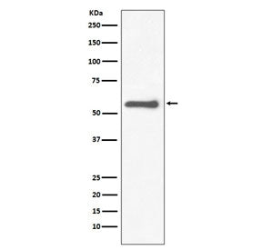 Western blot testing of rat PC-12 cell lysate with TH antibody. Predicted molecular weight: 55-60 kD