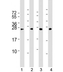 Western blot testing of human 1) HeLa, 2) HepG2, 3) Jurkat and 4) mouse NIH3T3 cell lysate with RAB5
