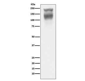 Western blot testing of human colon cancer lysate with CEA antibody. Expected molecular weight: 80~2