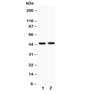 Western blot testing of Beta Arrestin 2 antibody and Lane 1: human HeLa; 2: rat skeletal muscle. Pre