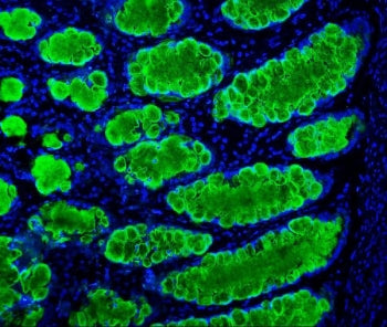 Immunofluorescent staining of FFPE human intestinal cancer with Mucin 2 antibody (green) and DAPI (b