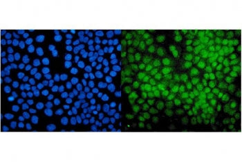 PIAS1 Antibody