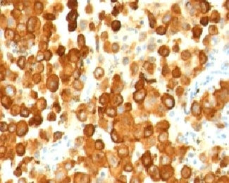 PMEL17 / Melanoma gp100 Antibody