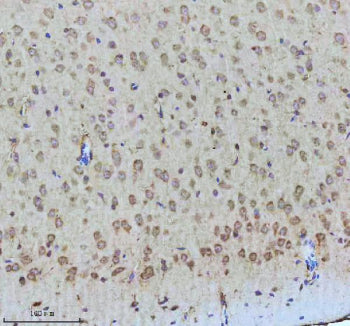 Immunohistochemical staining of Tuberin/TSC2 (Phospho-S939) using anti-Phospho-Tuberin (Ser939) anti