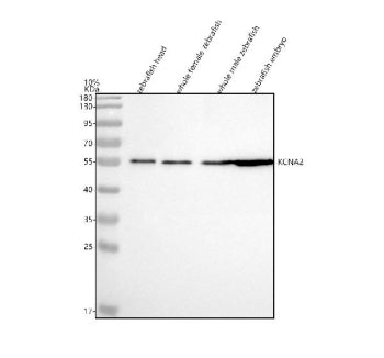 Western blot analysis of Kv1.2/Kcna2a protein using Zebrafish Kv1.2 antibody and 1) zebrafish head, 