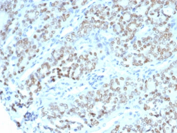 BTBD9 Antibody / BTB/POZ domain-containing protein 9