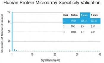 Analysis of HuProt(TM) microarray containing more than 19,000 full-length human proteins using KRT14