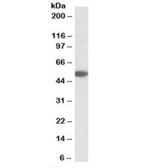 Western blot testing of albumin-depleted human serum lysate with SERPINA1 antibody at 0.1ug/ml. Expe