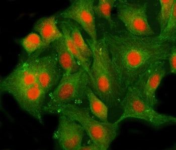 Immunofluorescent staining of FFPE human A549 cells with AF10 antibody (red) and Beta Tubulin mAb (g