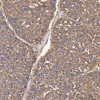HSD11B2 Antibody / HSD11K