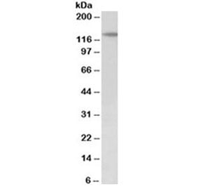 Western blot testing of mouse fetal kidney lysate with PTCH1 antibody at 2ug/ml. Predicted molecular