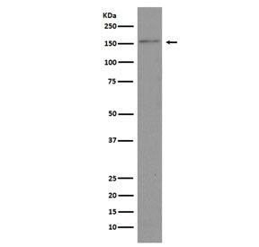 Western blot testing of human HeLa cell lysate with Brd4 antibody. Predicted molecular weight ~156 k