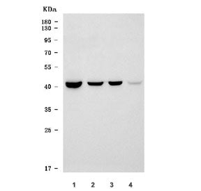 TM6SF2 Antibody