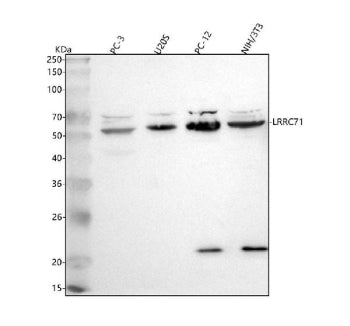 Western blot analysis of C1orf92/LRRC71 using anti-LRRC71 antibody. Lane 1: human PC-3 whole cell ly