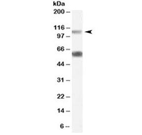 Western blot testing of rat pancreas lysate with OGT antibody at 0.05ug/ml. Molecular weight: the ex