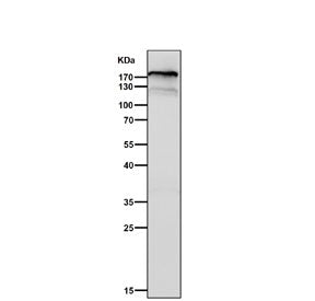 Western blot testing of human MCF7 cell lysate with C3 antibody. Expected molecular weight: ~185 kDa