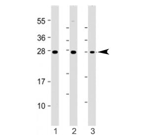 ST8SIA1 Antibody (N-Terminal Region)